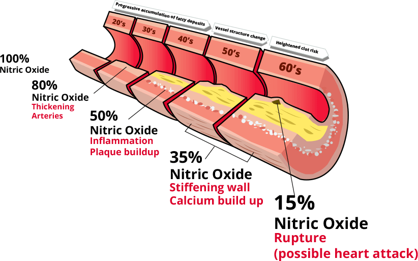 Nitric Oxide Production by age