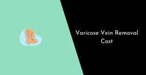 Varicose Vein Removal Cost